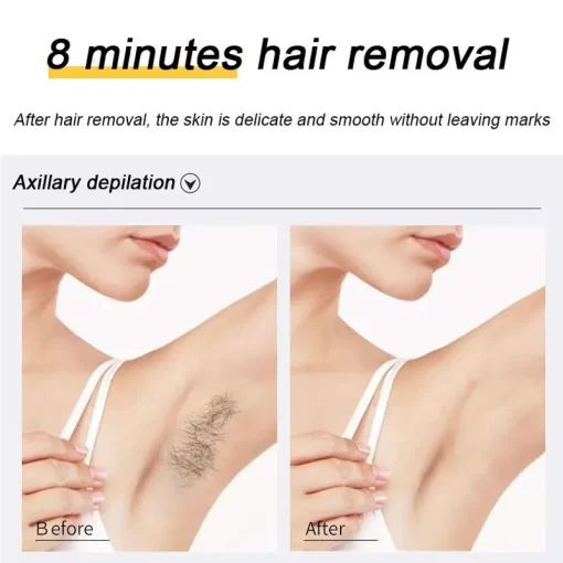 Makkafinds® Ecrin Hair Removal Spray