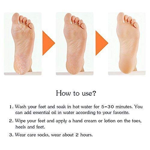 Makkafinds® Anti Crack Full Length Silicone Foot Protector