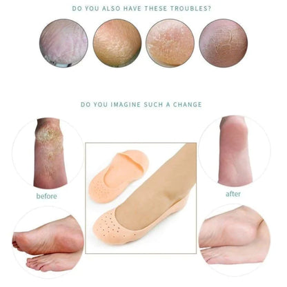 Makkafinds® Anti Crack Full Length Silicone Foot Protector