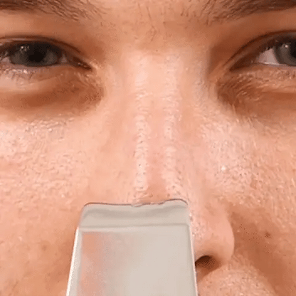 Makkafinds® Ultrasonic Facial Skin Scrubber