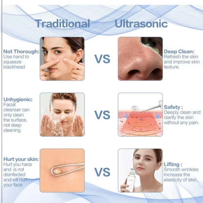 Makkafinds® Ultrasonic Facial Skin Scrubber