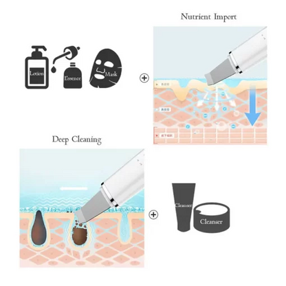 Makkafinds® Ultrasonic Facial Skin Scrubber