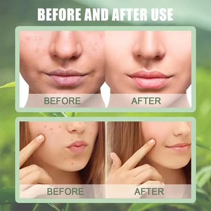 Makkafinds® The Magic Green Stick Mask