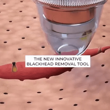 Makkafinds® Blackheads Remover Vacuum